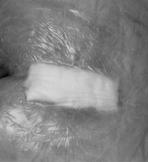 [90120] 3M™ Tegaderm™ Hi & Hg Alginate Dressing, 12" Rope