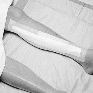 [3570] 3M™ Medipore™ +Pad Soft Cloth Adhesive Wound Dressing, 3½" x 8", Pad Size 1¾" x 6"
