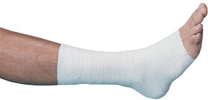 [01053] BSN Medical Gelocast® Unna Boot, 4" x 10 yds