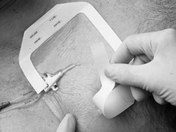 [1630] 3M™ Tegaderm™ Transparent Film Dressing Frame Style, 4" x 4½" with Labe