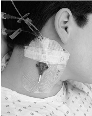 [1633] 3M™ Tegaderm™ IV Transparent Film Dressing With Border, 2¾" x 3¼"