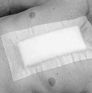 [2864] 3M™ Medipore™ H Soft Cloth Surgical Tape, 4" x 10 yds