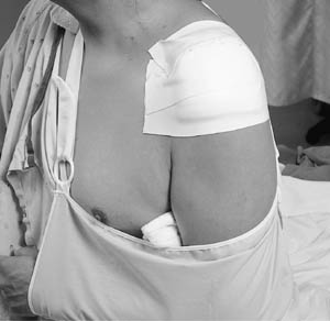 [1528-1] 3M™ Microfoam™ Surgical Tapes, 1" x 5½ yds (stretched)