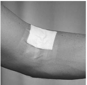 [1525-1] 3M™ Blenderm™ Surgical Tape, 1" x 5 yds