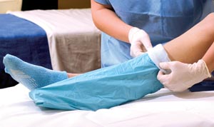 [20838] Alba Sterile Impervious Stockinette, 8" x 38", 12/cs