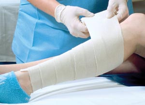 [730] Alba Non-Sterile Stockinette, 3" x 50 yds, Bias Cut Cotton