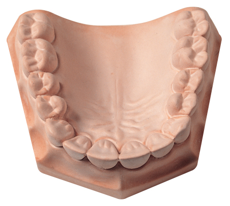 [330080] Whip Mix Snap-Stone: High-Strength, Fast-Setting Stone, Pink