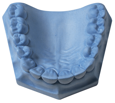 [330061] Whip Mix Quickstone: Economical Dental Laboratory Stone , Blue