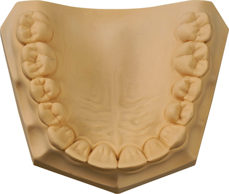 [330051] Whip Mix - Buff Stone 15kg (33lb) Carton