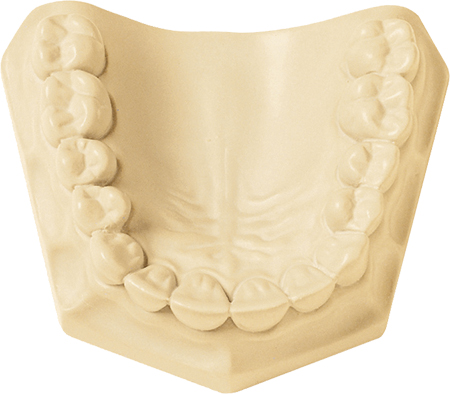 [330023] Whip Mix Silky-Rock: Low-Expansion Die Stone, Ivory