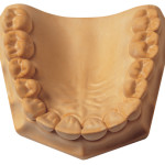 [02038] Whip Mix - Silky-Rock Low-Expansion Die Stone Yellow 120-70 g package