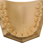 [330011] Whip Mix ResinRock: Resin-Fortified, Low-Expansion Die Stone, Golden Brown