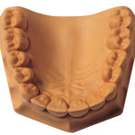 [34991] Whip Mix - ResinRock Resin Fortified, Low Expansion Die Stone Peach 25 - 70 g Package (Case of 4