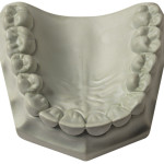 [330012] Whip Mix ResinRock: Resin-Fortified, Low-Expansion Die Stone, Green