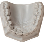 [330013] Whip Mix ResinRock: Resin-Fortified, Low-Expansion Die Stone, Grey