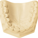 [330003] Whip Mix Hard Rock Ivory: High-Strength, High-Expansion Die Stone