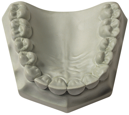 [32077] Whip Mix - High-Strength, High-Expansion Die Stone 120 - 70 g Package