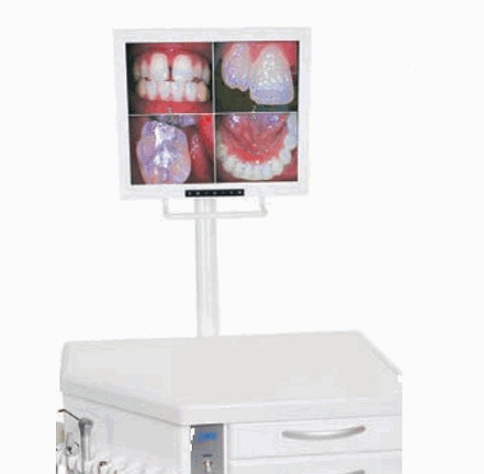 [OMC-2200] TPC Monitor Bracket for Ortho Cabinet