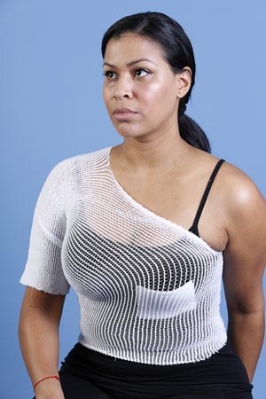 [MT9X24] MT Spandage Tubular Retainer Net, Latex-Free, Pre-Cuts, Large Chest, Back, Perineum, Axilla, Size 9, Length 24in, 50/cs