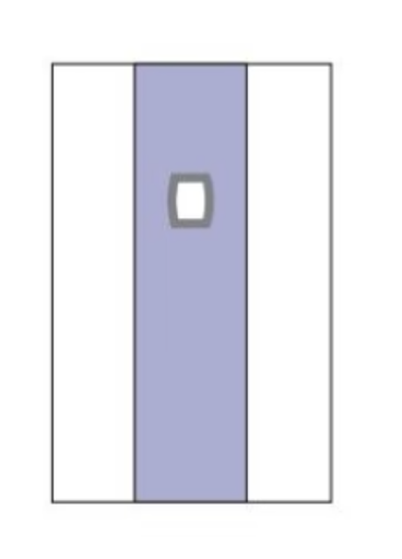 [C2304] Pacemaker Drape, 80"x120", Clear Side Panels, Sterile, 20/cs