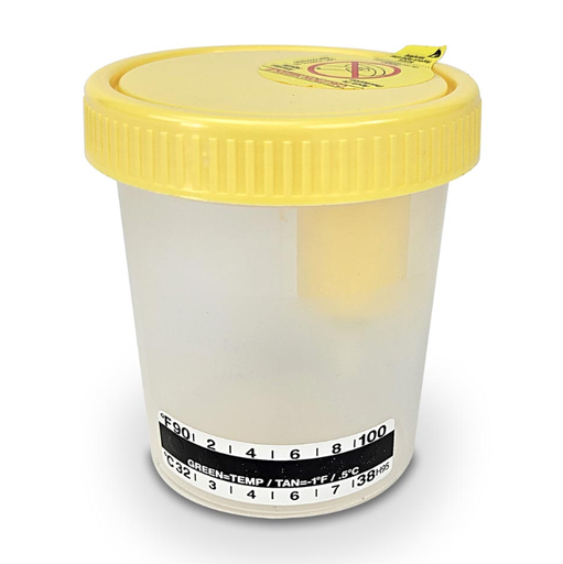 [3856TP] Globe Scientific Urine Collection Containers