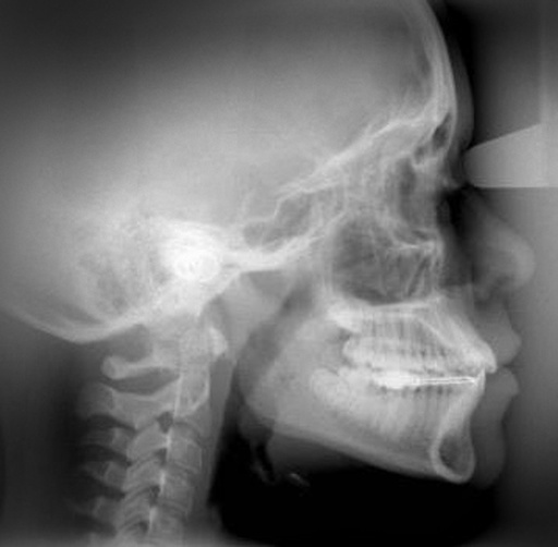 [4851] Wehmer X-ray Film 8" x 10" Cephalometric Film (100 sheets per box)