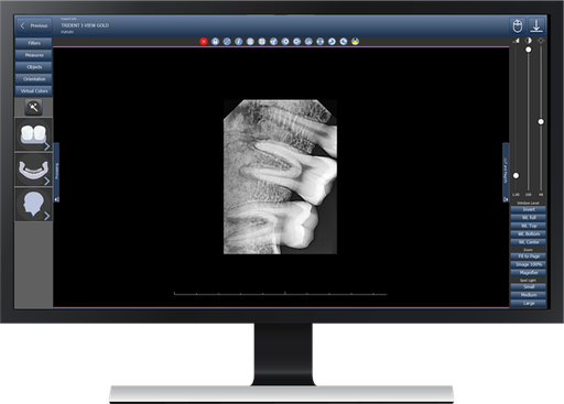 [DP2] Deepview Software