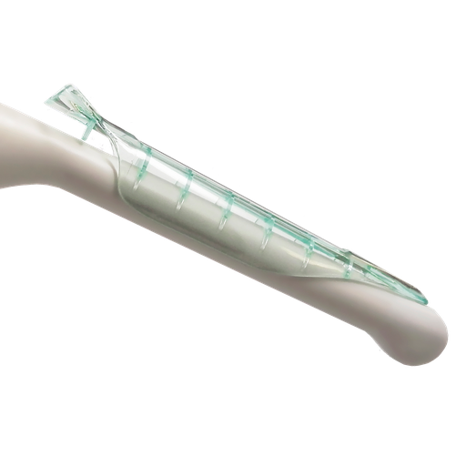 [1-535-9000] Endocavity Needle Guide, Sterile, Compatible with Esaote E8-5 R10; Mindray EV6.5 MHZ/R10, 6CV1, 6CV1P, 6CV1s, 65EC10EA, 65EC10EB, 65EC10HA, CB10-4, CB10-4e, CB10-4s, V10-4, V10-4B, V10-4BP, V10-4Bs, V10-4s, V11-3, V11-3B, V11-3BE, V11-3E, V11-3H, V11-3HE, V11-3Hs, V11-3HU, V11-3s, V11-3WE; Samsung EC4-9ES, EC4-9IS, ER4-9ES, 10R EV/140D; Siemens 6.5 EC10, EC7, EC9-4, EV9-4; Supersonic Imagine SE12-3, SEV12-3; Terason 8EC4(V); Zonare E9-3, 24/bx