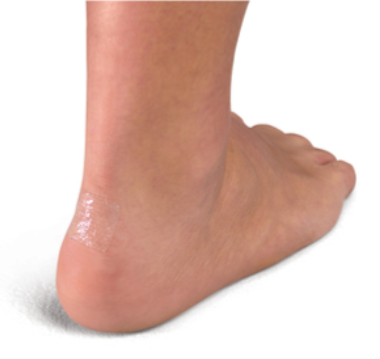 [131411] More Skin, 1" Square