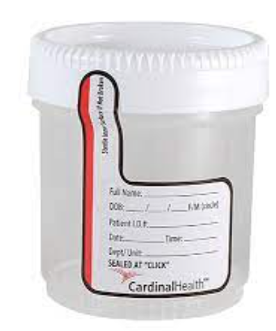 [CHB13902P] Specimen Container with White Lid, 3 oz, 45 mm, Polypropylene, Sterile, 100/pk, 4 pk/cs 